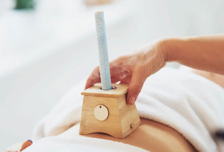 Moxibustion, a popular Chinese medicine modality. 